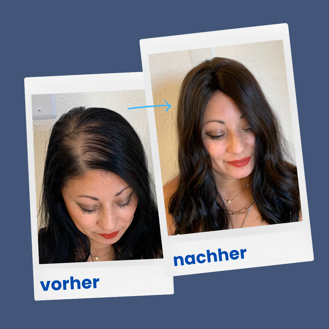 ShinyHair Premium Kollagenpulver