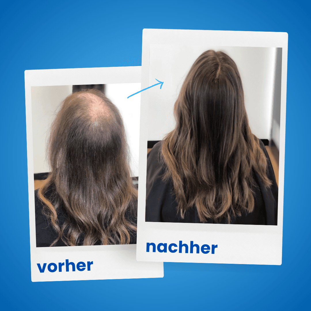 ShinyHair Haarwuchsbooster Sale