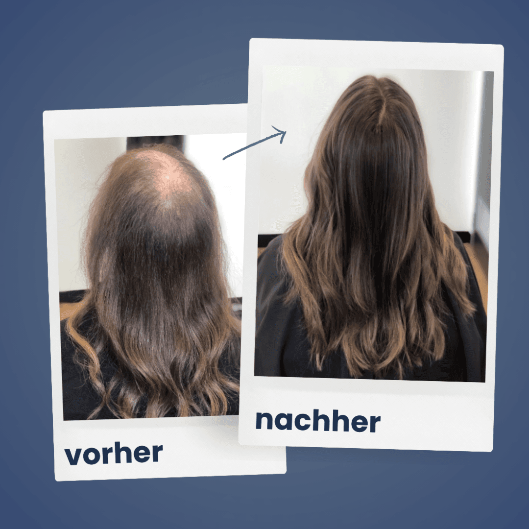 Glanzend Haar | reparatieset